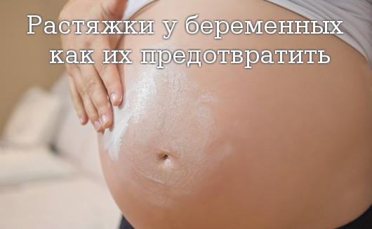 Растяжки у беременных